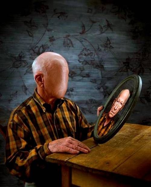 Лечение деменции